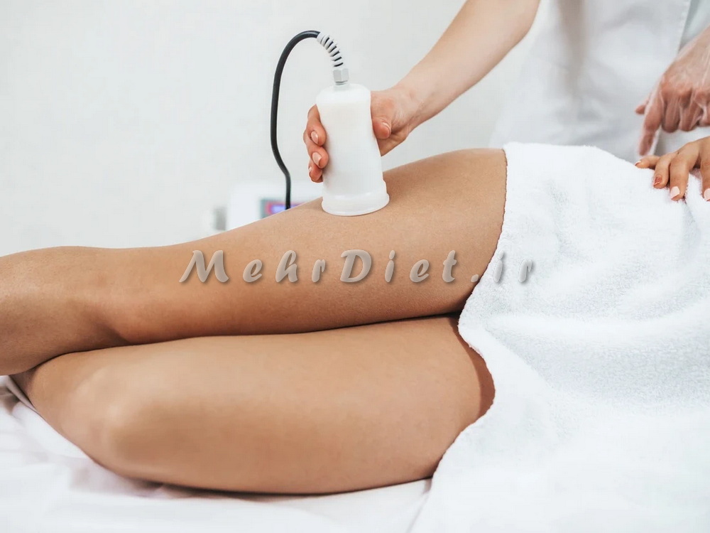 لاغری موضعی باسن (5)